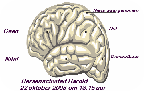 Mijn hersenactiviteit